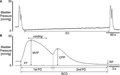 Blockade of Acid-Sensing Ion Channels Increases Urinary Bladder Capacity With or Without Intravesical Irritation in Mice